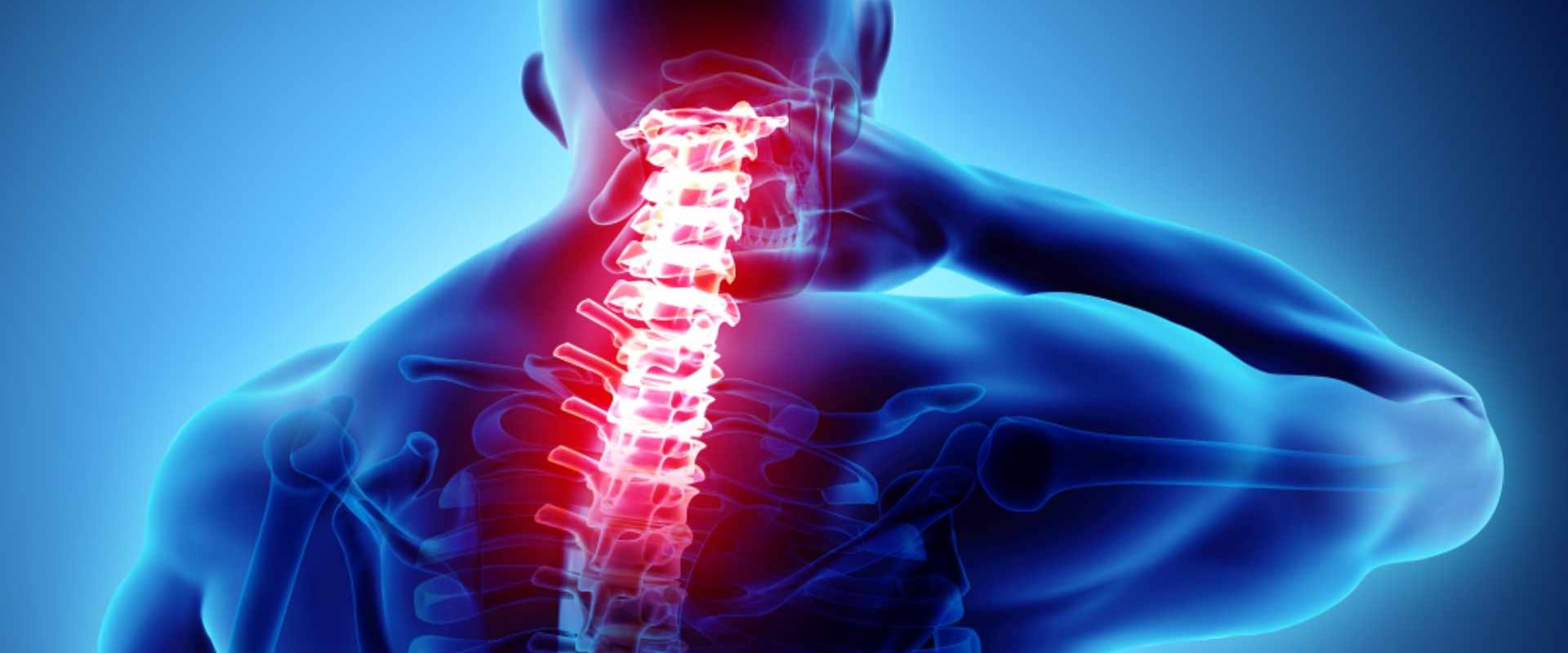 What does severe neck pain indicate?