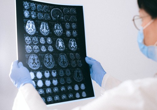 Relieving Neck Pain With Interventional Neurology In Virgin Islands: What You Need To Know
