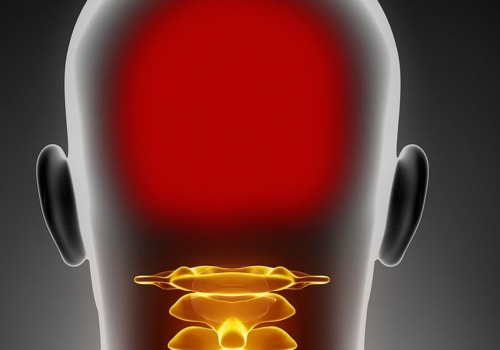 Are headaches and neck pain related?